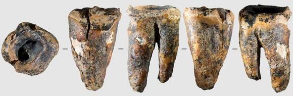 59,000-Year-Old Neanderthal Tooth May Reveal the Earliest Known Dental ...