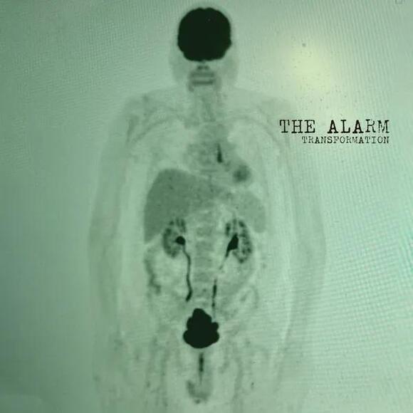 Album Review: The Alarm – Transformation - NewsBreak