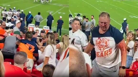 Bears Fan Was Left Seriously Injured & Bloodied All Over After Massive ...