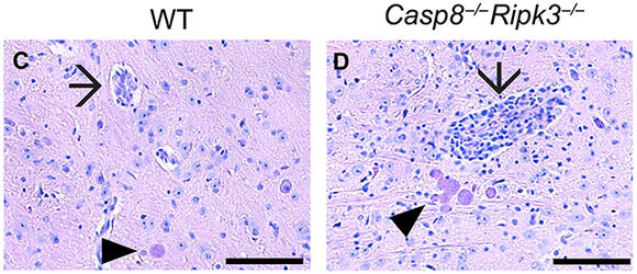 Immune Cells Do Something Unexpected to Stop This Brain Parasite From ...