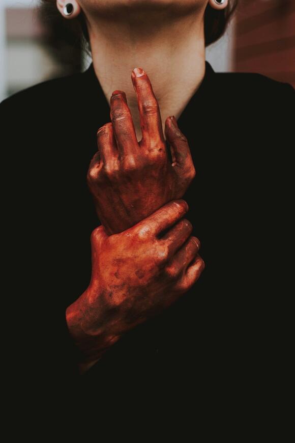 Hand Injuries from Fireworks: A Harsh Reality - Graphic X-Rays Ahead ...