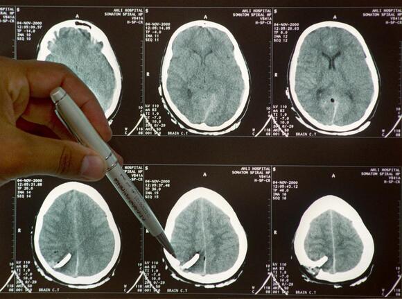 Is air pollution now bad for your brain? - NewsBreak