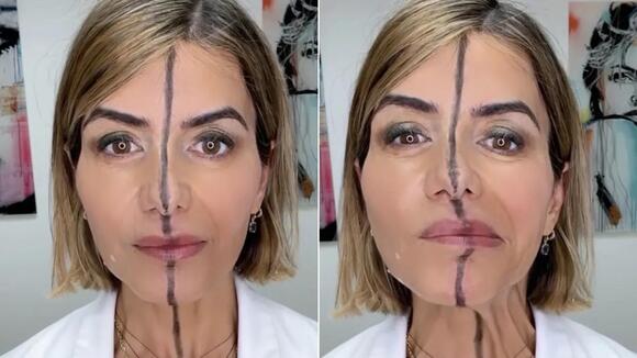 Woman injects just half of her face with botox to show exactly what it ...