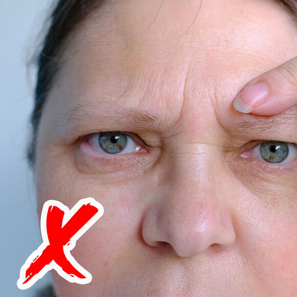 6 Worst Junk Foods That Can Weaken Skin Elasticity As You Age