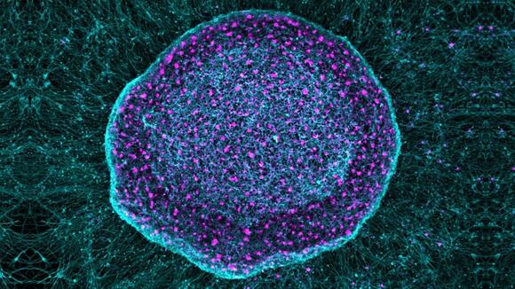 'Pain sponge' derived from stem cells could soak up pain signals before ...