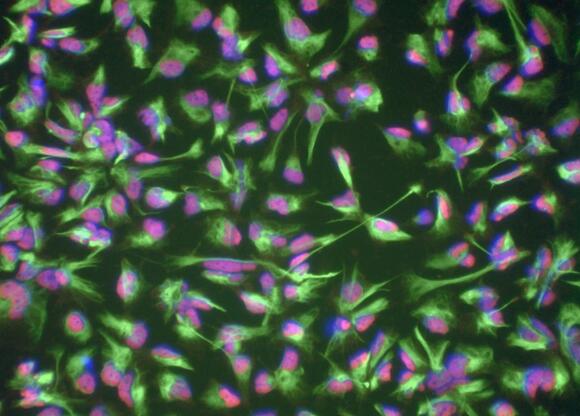 Blood Cells From an 80-Year-Old Were Reprogrammed to Show an Epigenetic ...