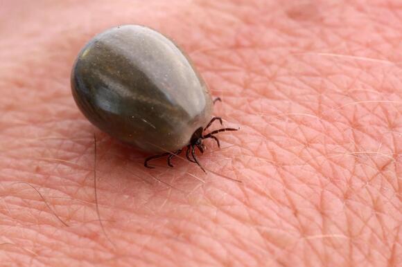 Odd Ways To Prevent Tick Bites In Montana - NewsBreak