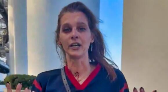 Fans Are Now Boycotting NFL Games After Horrifying Scene That Left Female  Fan Gushing Blood Went Viral [VIDEO] - NewsBreak