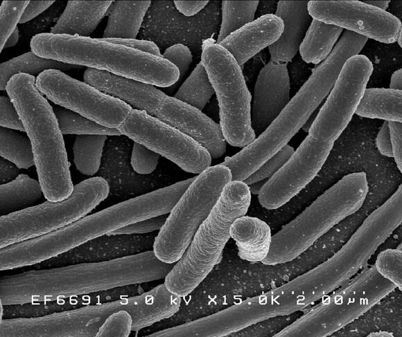 E. coli detected in Maricopa water sample, resolved within days - NewsBreak