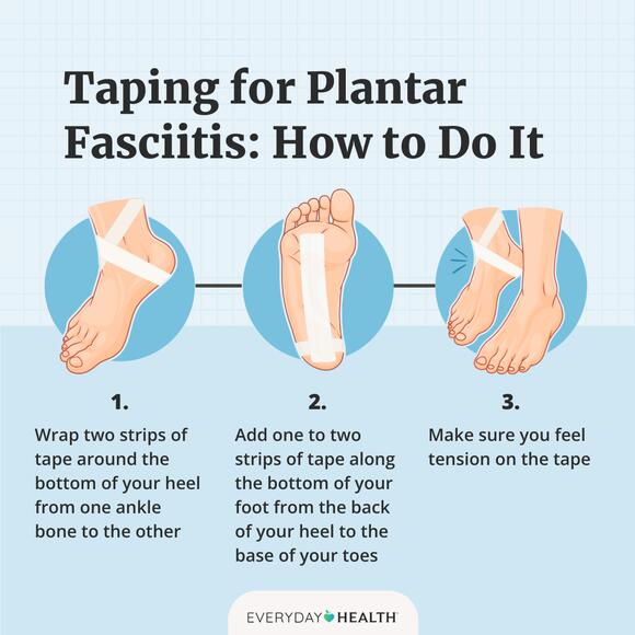 Does Foot Taping for Plantar Fasciitis Really Help?