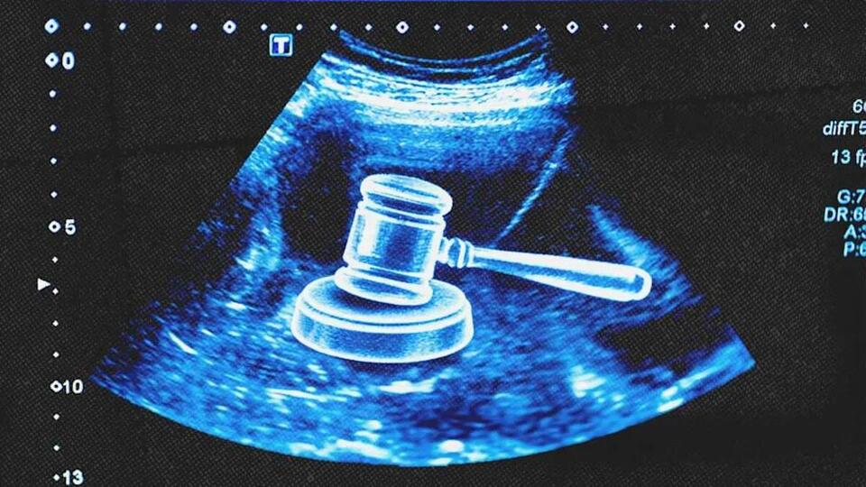 Arizona Man Awarded $67,500 on Behalf of Aborted Embryo - NewsBreak