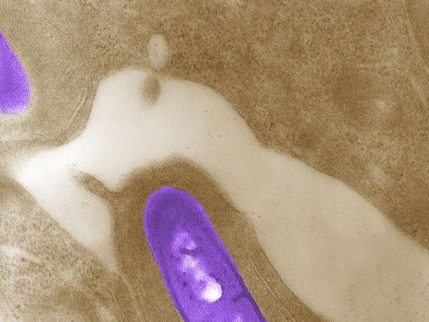 Listeria Outbreak Linked to Deli Meats Claims Five More Lives, CDC Says