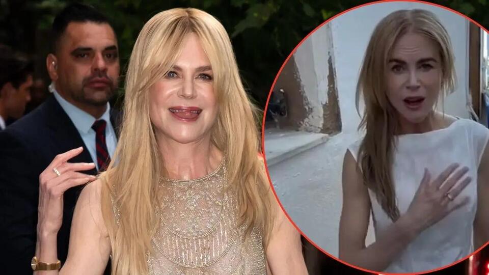 nicole kidman plastic surgery Image 2