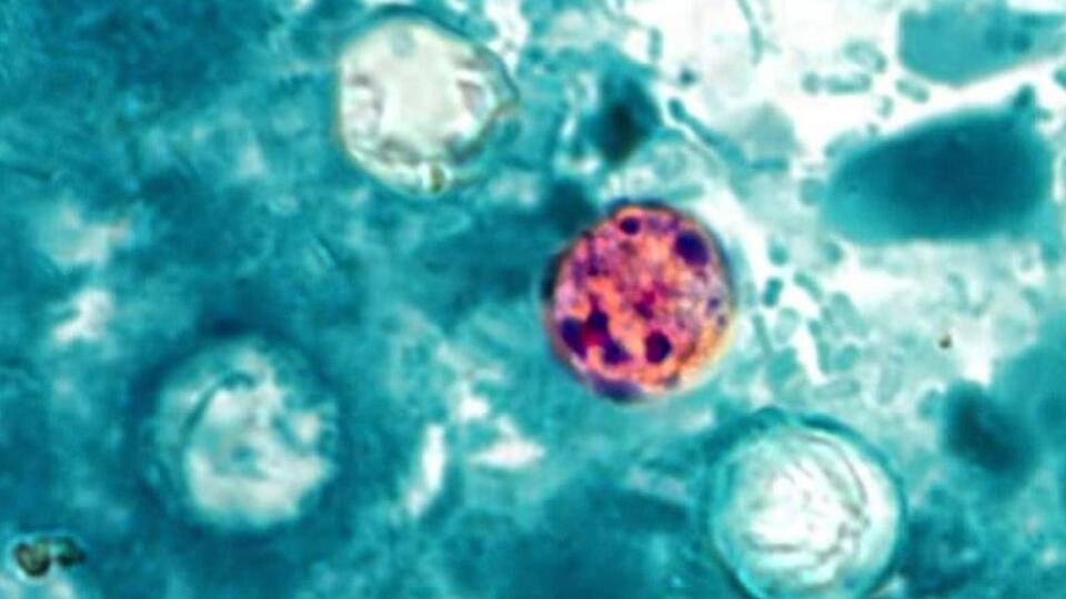 Parasitic outbreak linked to iceberg lettuce is over, CDC says