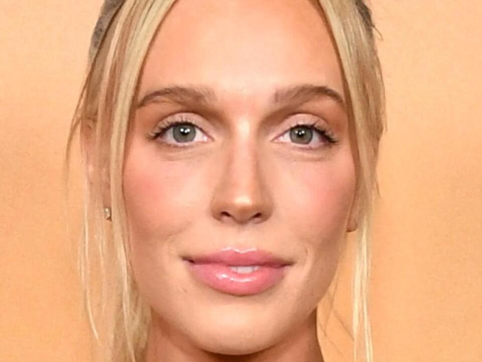 Alex Cooper's Stunning Transformation Is Turning Heads