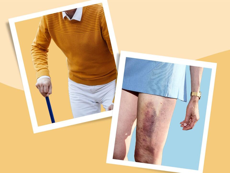 Is Hip Flexor Pain Slowing You Down?