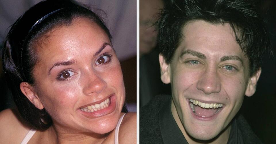 An Ode To The Days When Celebrities Had Teeth That Actually Looked Like ...