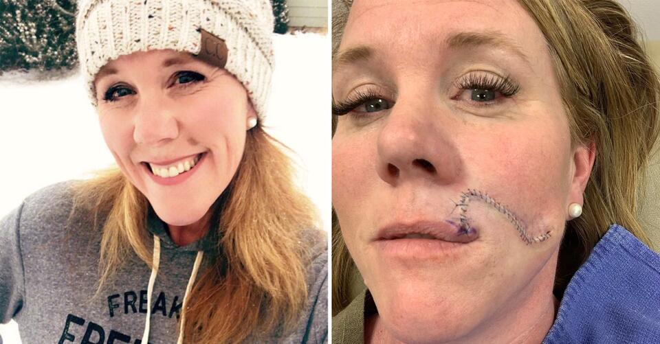 What I thought was a beauty mark turned out to be cancer – NewsBreak