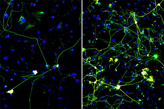 A quick squeeze helps CRISPR turn skin cells into neurons more ...