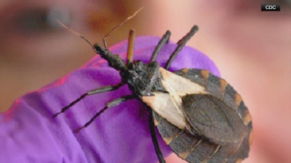 Experts in Texas warn that potentially deadly 'kissing bug' disease is ...
