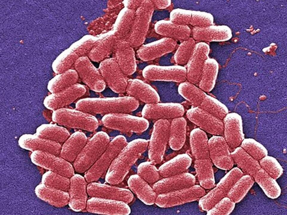 Urgent E coli health warning as more than 100 cases linked to ...