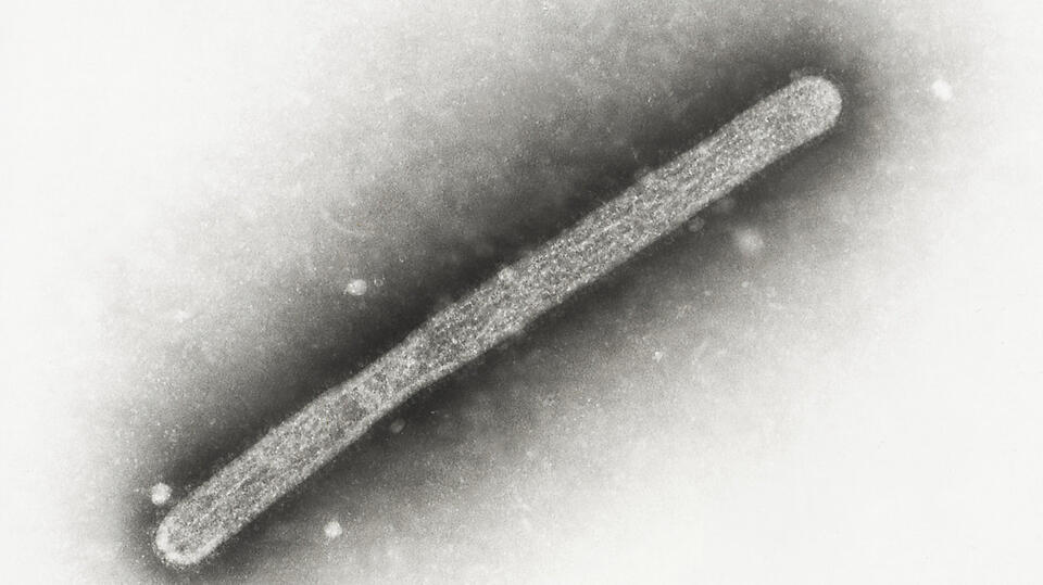 Case of avian influenza identified in Racine County poultry flock ...