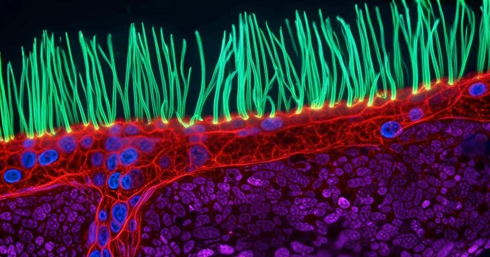 Nikon ‘Re-Reviewing’ Winner of Small World in Motion Contest After AI ...