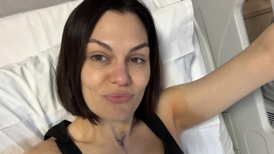 Jessie J Shares Recovery Update & Hospital Photos After Second Breast ...