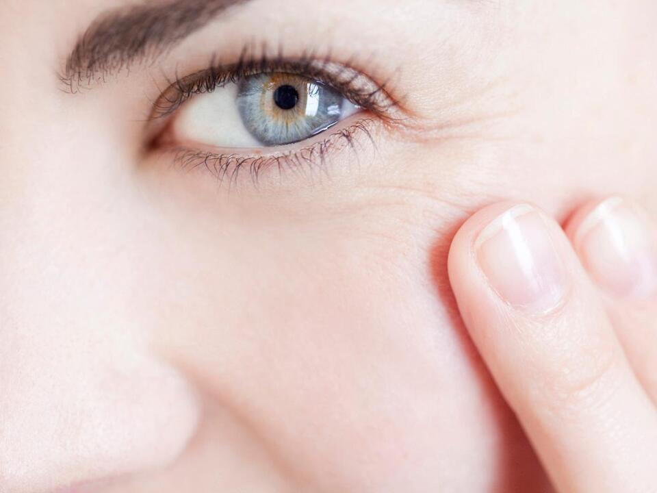 How to Treat and Prevent Crow's Feet, According to Experts