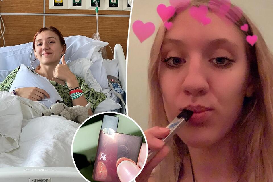 I was a teen vaping addict — I finally quit after my lung collapsed ...