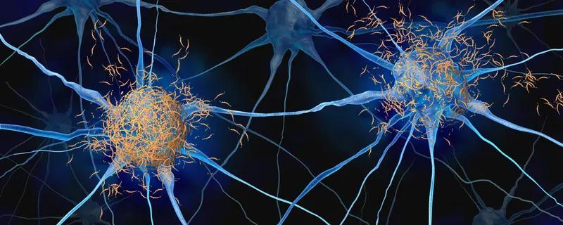Shape-Shifting Tau Filaments Could Lead to New Dementia Therapies ...