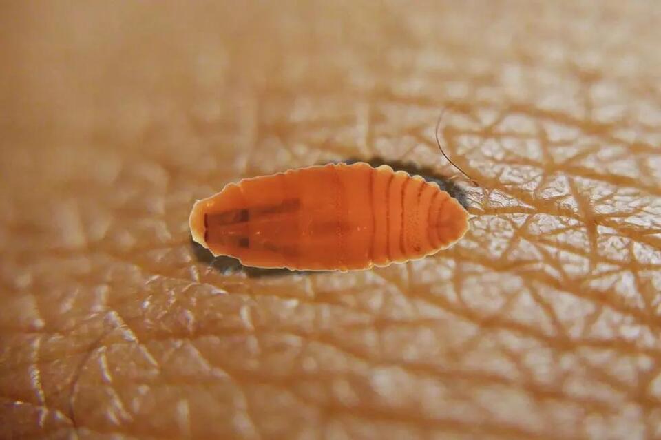 Texas Officials Warn About Flesh-Burrowing Parasitic Worms - NewsBreak