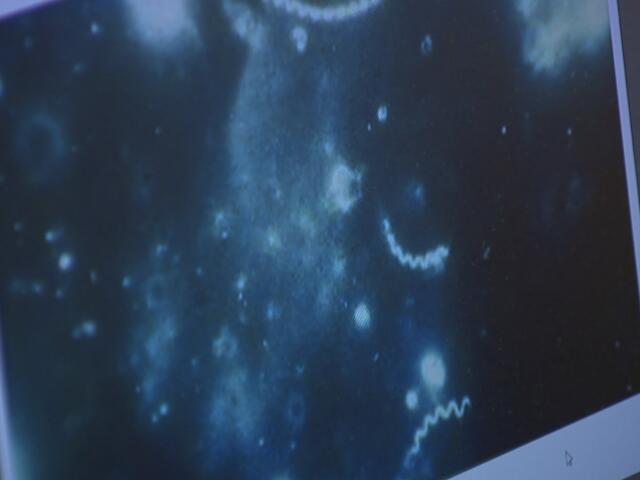 Syphilis cases rising in Northeast Ohio - NewsBreak