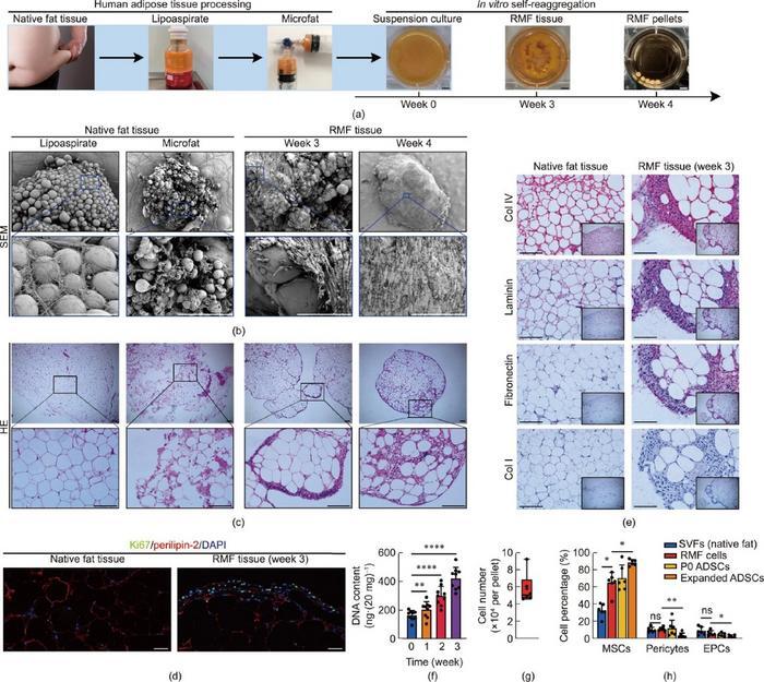 Human adipose tissue: a new source for functional organoids - NewsBreak