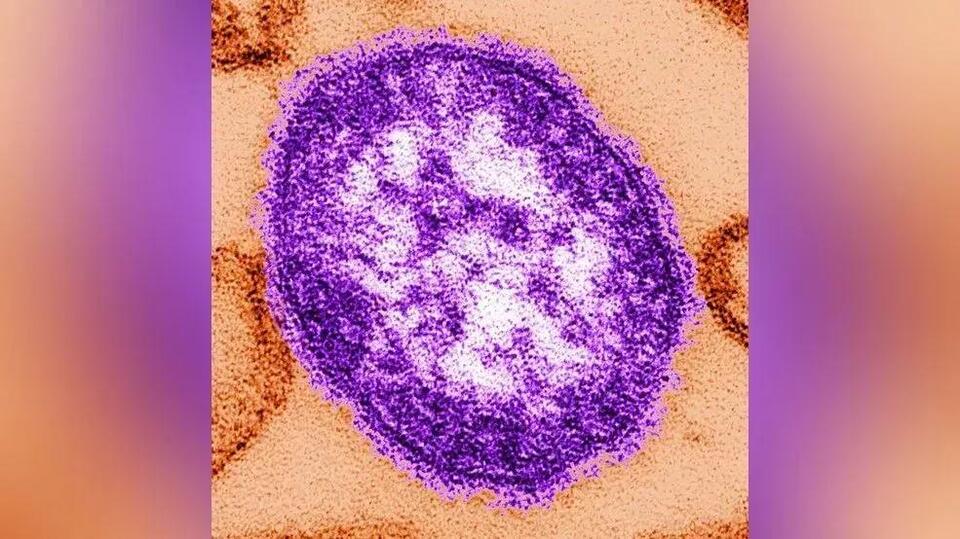 DHSS warns of measles exposure at Sedalia train station
