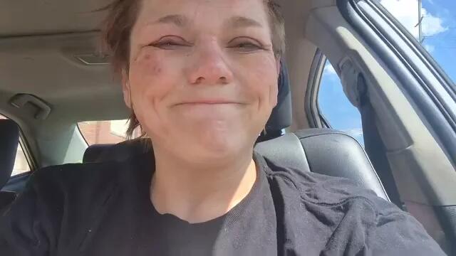 Indie wrestler Mickie Knuckles ‘badly burned’ in fire spot gone wrong ...