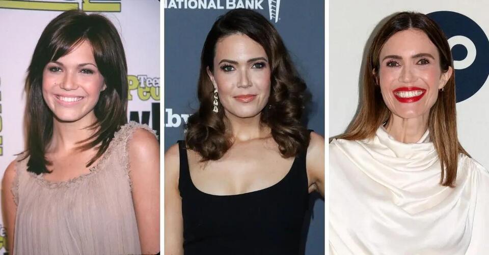 Did Mandy Moore Get Plastic Surgery? See Her Transformation in Before