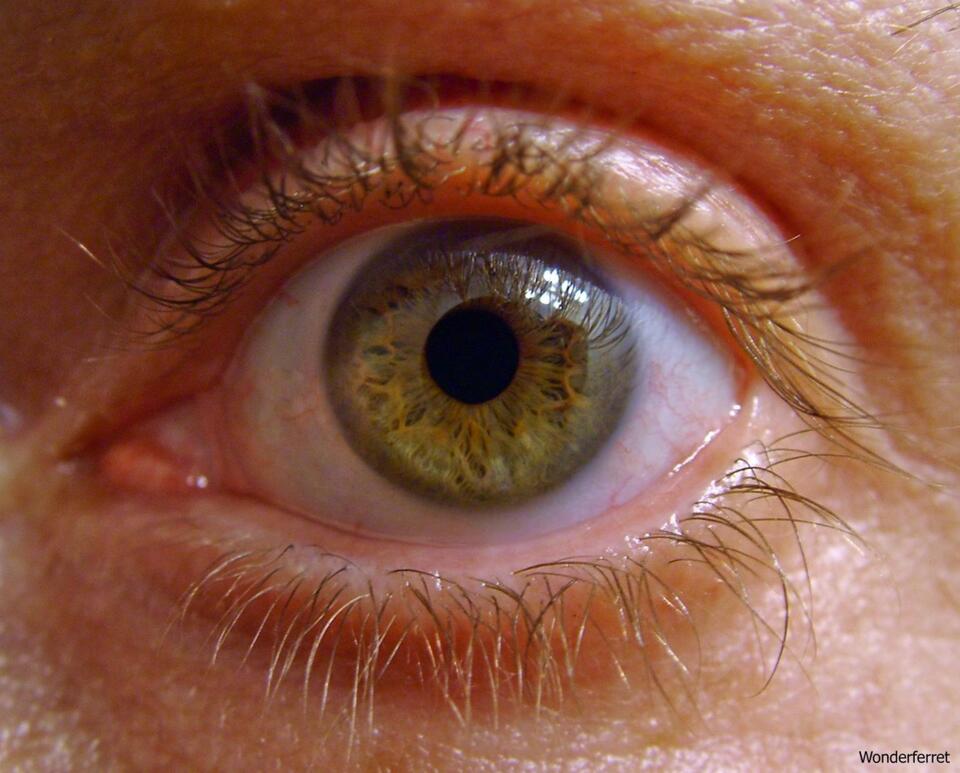 Why Some People Are Born With Two Rows of Eyelashes - NewsBreak