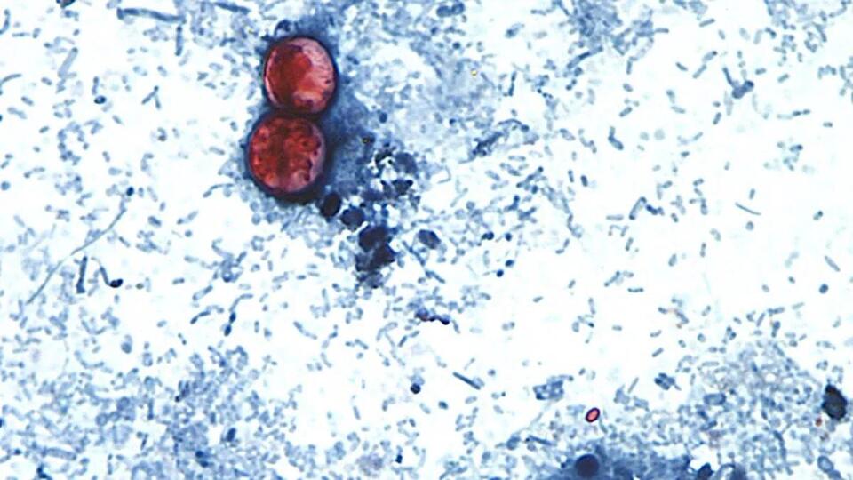 No, you shouldn't try to get the ‘diarrhea parasite'