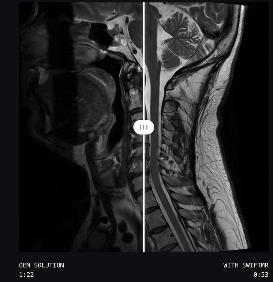 AI-Powered MRI Software Gets Expanded FDA Clearance for Use with Deep ...