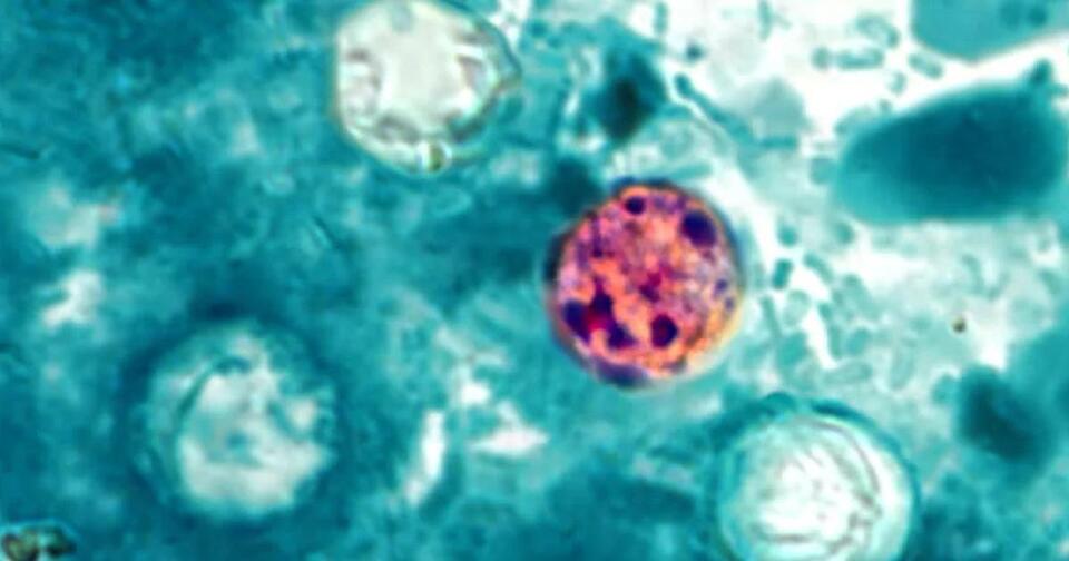 Vorsichtsmaßnahmen bei Taco Bell und die Rolle von Cyclospora