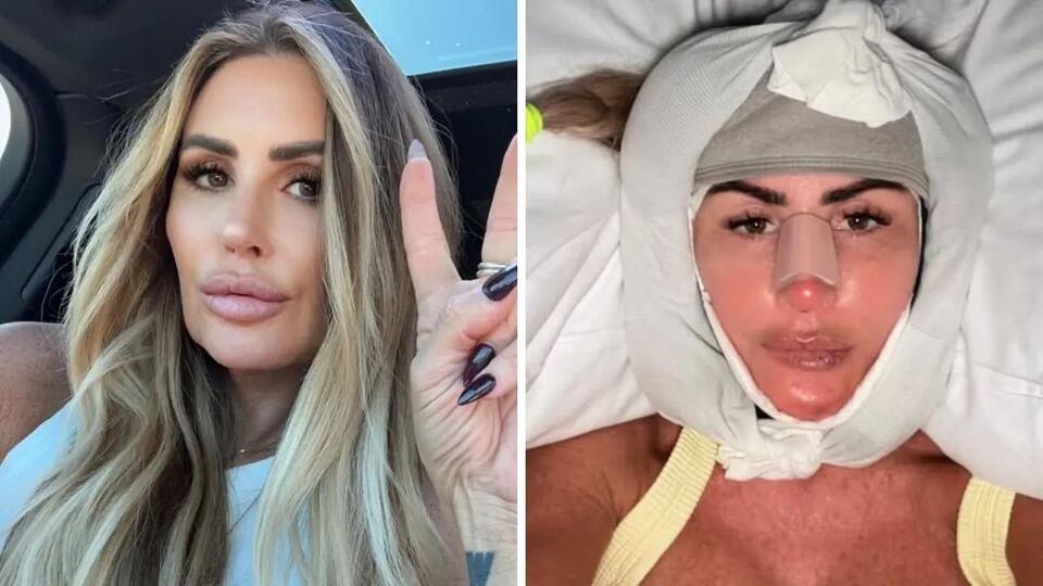 Tiger Woods' Ex-Mistress Rachel Uchitel Facelift Transformation in ...