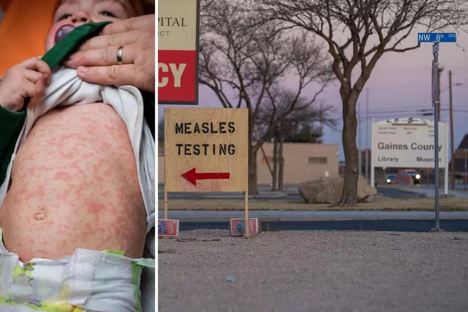 Unvaccinated At Risk As Texas Measles Cases Continue To Rise - NewsBreak