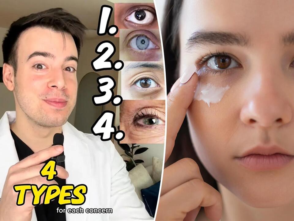 4 common types of dark circles — and how to treat them, according to a