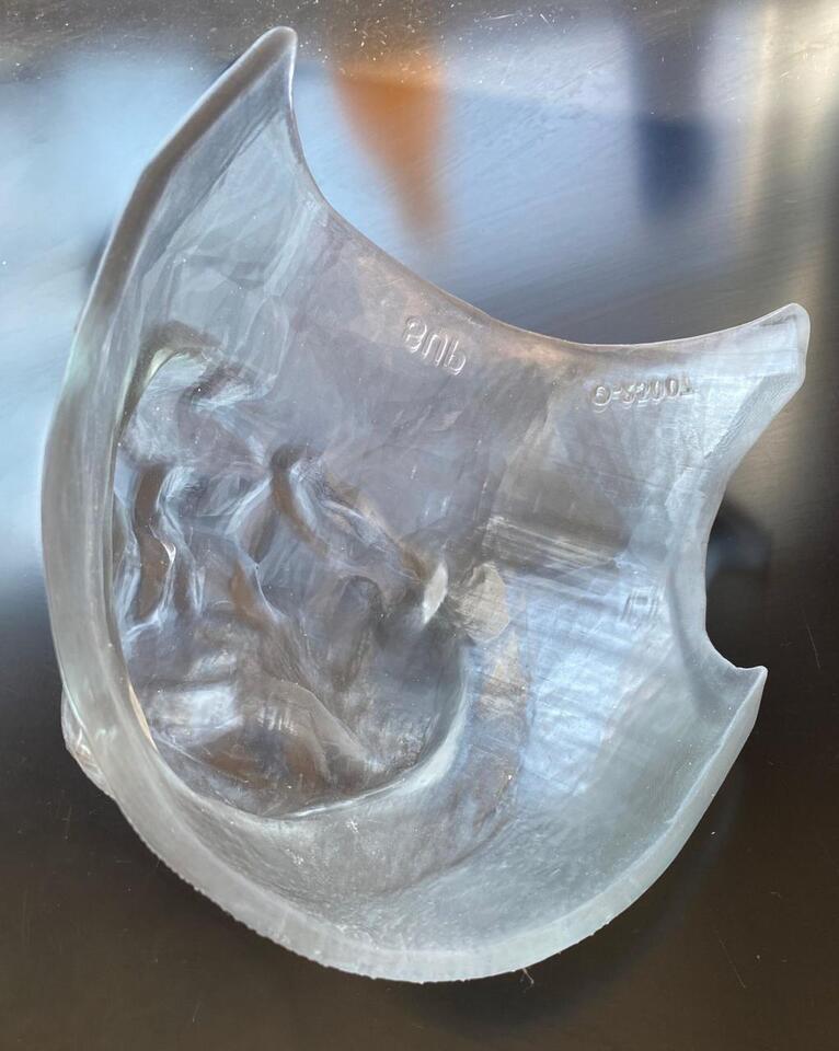 3D Printing News Briefs, October 14, 2026: Bolus, Aerospace Tooling ...