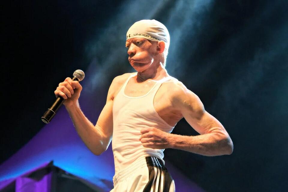 The Meaning Behind Yellowman’s “Zungguzungguguzungguzeng”: Lyrics ...