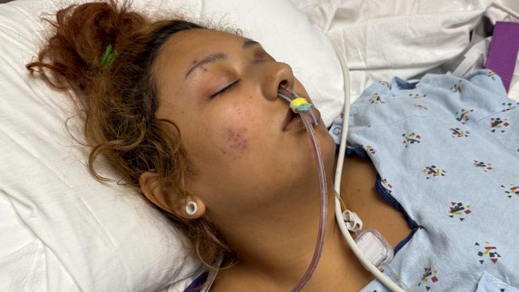 Family seeks justice after 20-year-old cyclist loses leg in crash ...