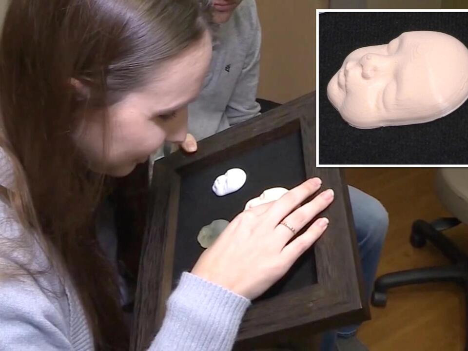 Pregnant mom with visual impairment ‘sees’ baby with 3Dprinted ultrasound