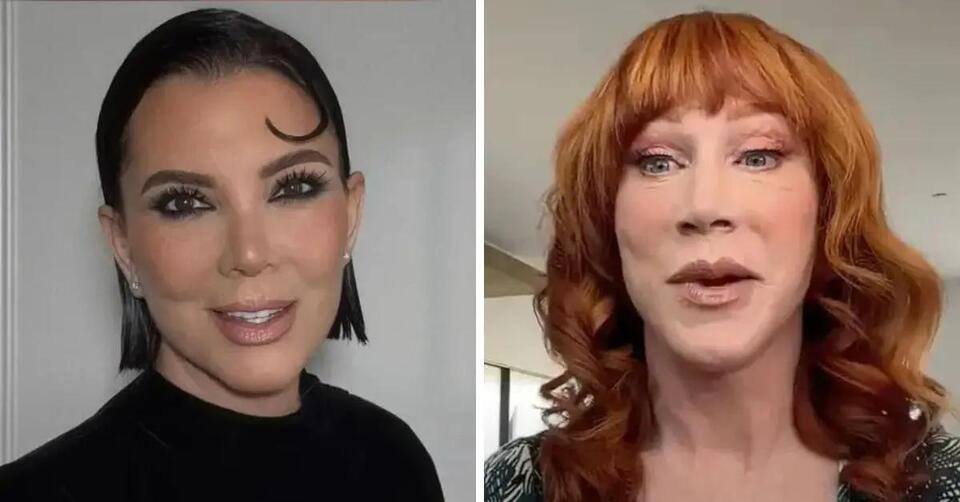 10 Celebrities Who Have Had a Facelift See Shocking Before and After