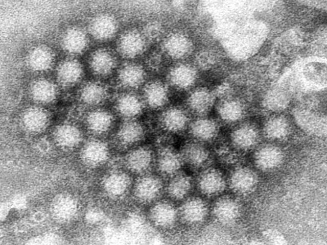 Cases of fast-moving stomach bug norovirus rise across U.S. - NewsBreak